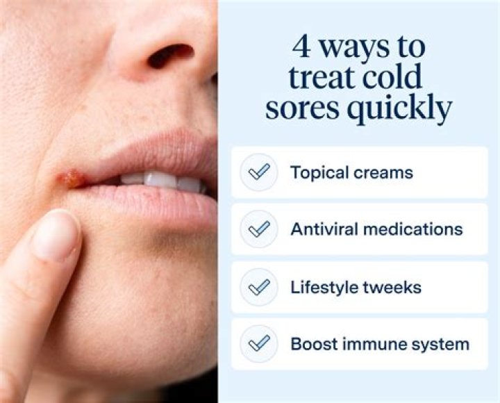 how to treat a cold