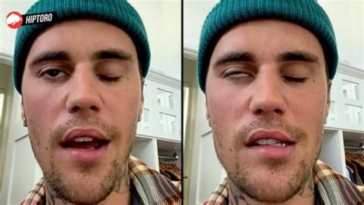 JUSTIN BIEBER HEALTH