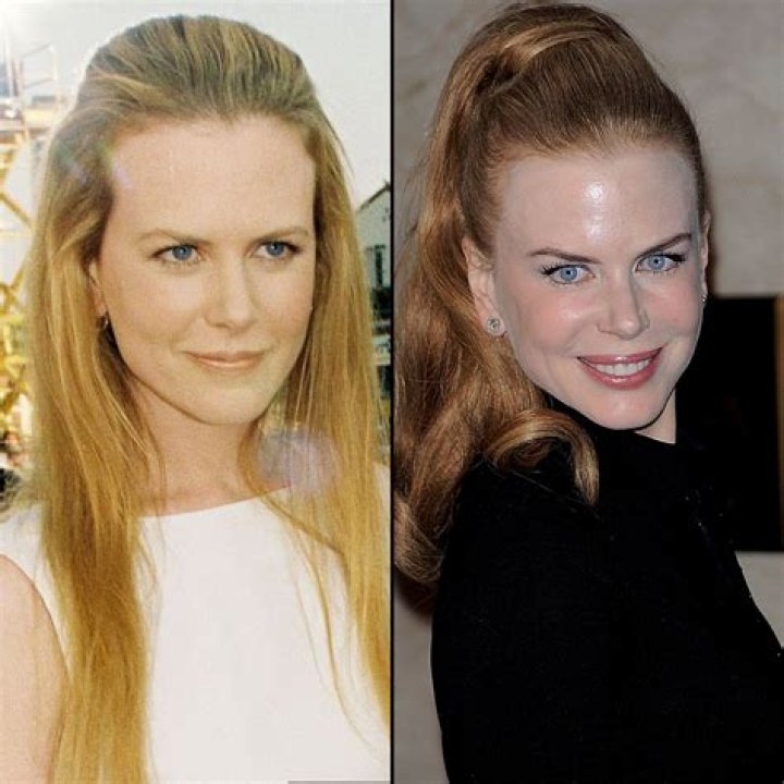 Nicole Kidman